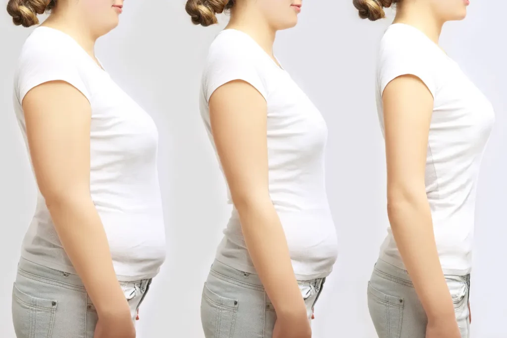 weight loss progression GLP-1 injections Kansas City semaglutide and tirzepatide